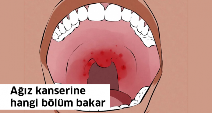 Ağız kanserine hangi bölüm bakar