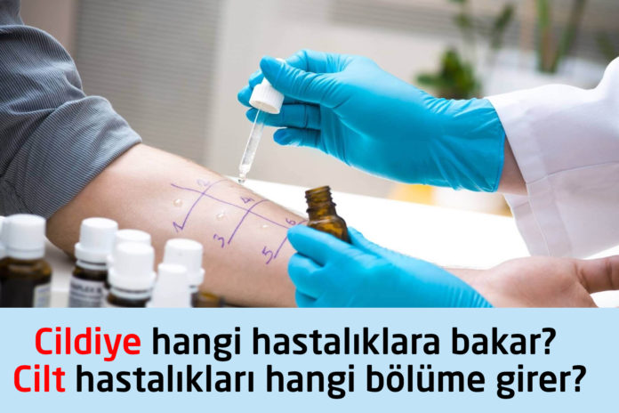 cildiye hangi hastaliklara bakar cilt hastaliklari hangi bölüme girer